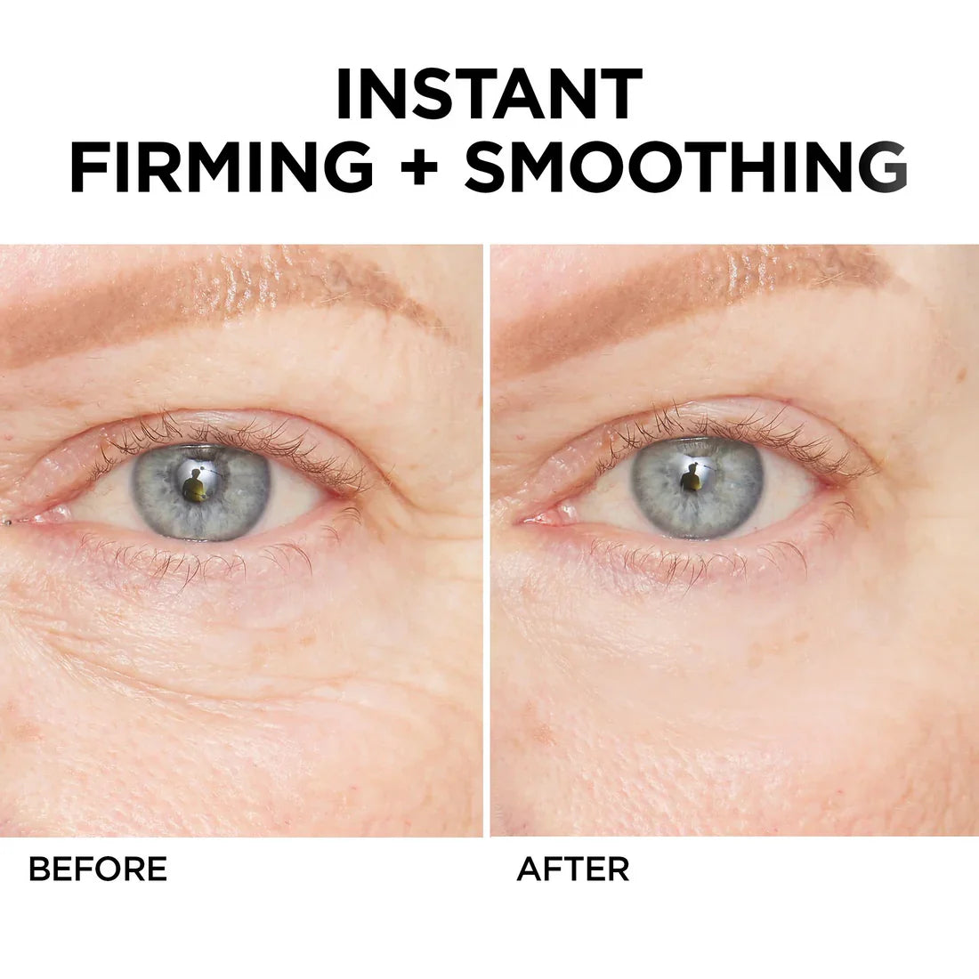 🚨𝑳𝑨𝑺𝑻 𝑫𝑨𝒀 𝑫𝑰𝑺𝑪𝑶𝑼𝑵𝑻: 𝟖𝟕% 𝑶𝑭𝑭 🔥 Instant Wrinkle Eye Tightener Cream