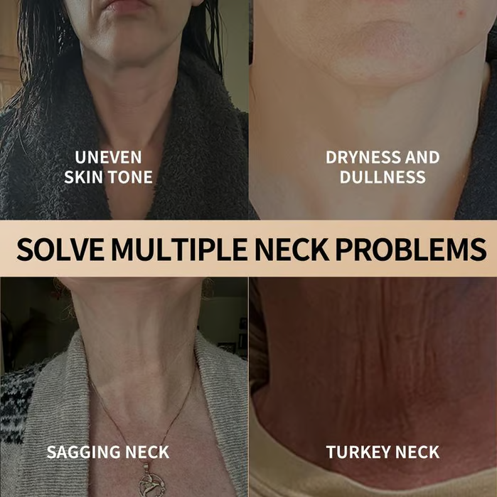 Neck & Eye Care Set – Tighten, Smooth & Hydrate ✨ All-in-One Moisturizing Treatment for Delicate Skin 💧