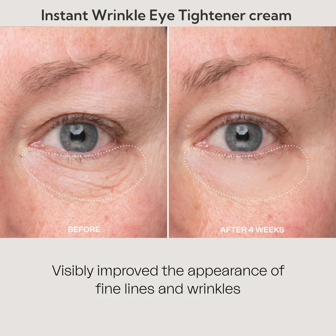 🚨𝑳𝑨𝑺𝑻 𝑫𝑨𝒀 𝑫𝑰𝑺𝑪𝑶𝑼𝑵𝑻: 𝟖𝟕% 𝑶𝑭𝑭 🔥 Instant Wrinkle Eye Tightener Cream