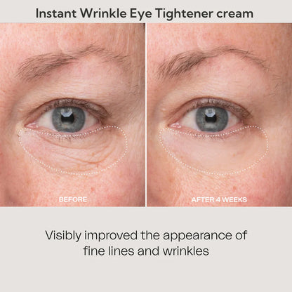 🚨𝑳𝑨𝑺𝑻 𝑫𝑨𝒀 𝑫𝑰𝑺𝑪𝑶𝑼𝑵𝑻: 𝟖𝟕% 𝑶𝑭𝑭 🔥 Instant Wrinkle Eye Tightener Cream