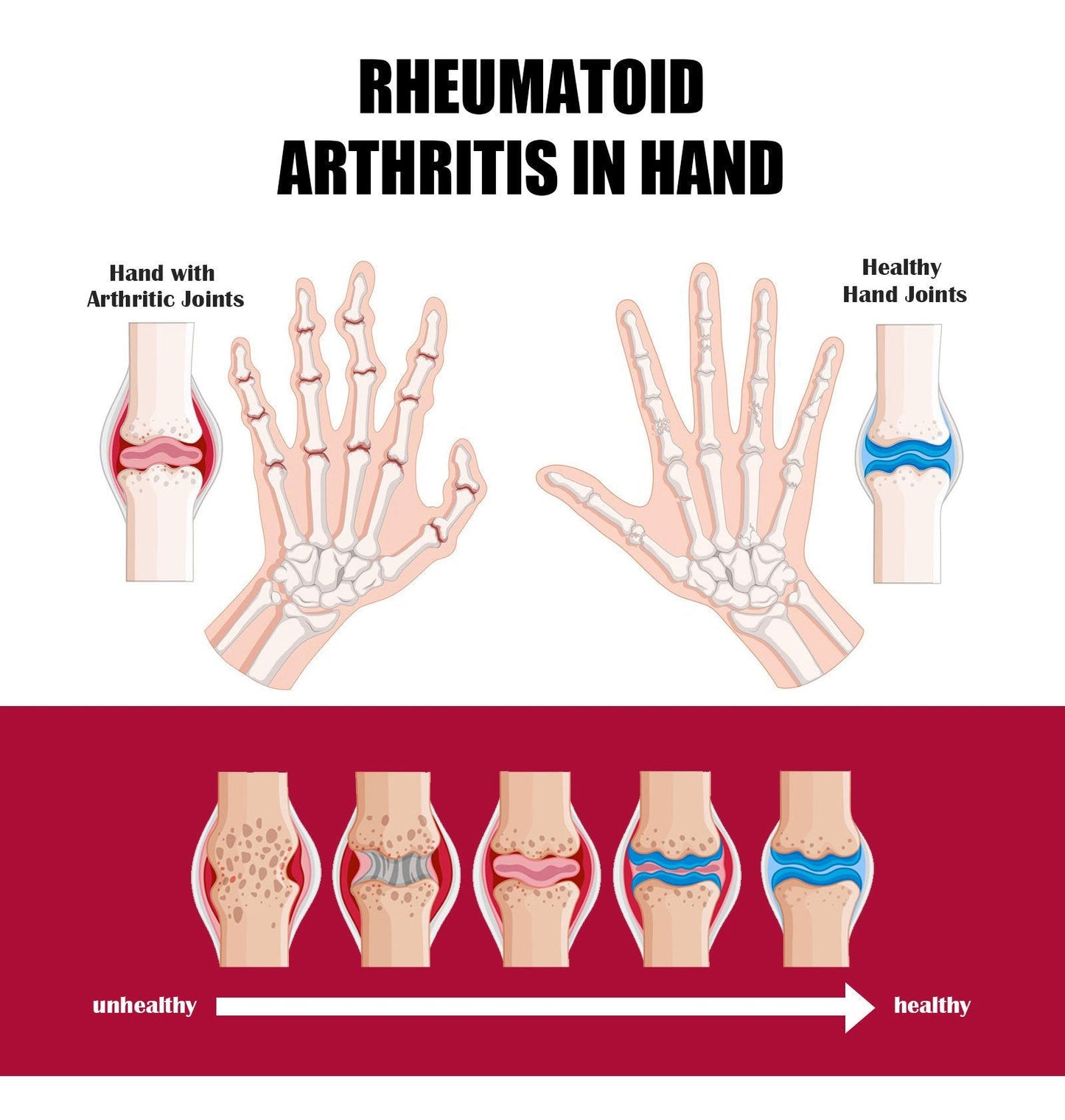 🐝 Beevana Bee Venom Cream – Natural Relief for Your Joints and Bones 🎯 Exclusive Offer Today: Buy 2 Get 1 Free!