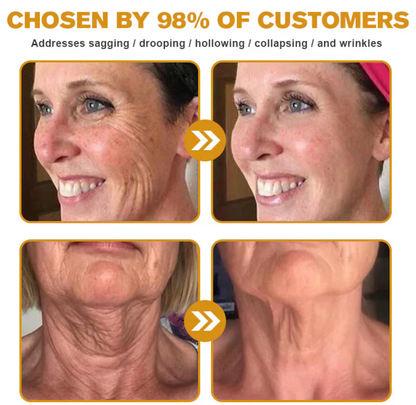 Mayo Clinic Official: AllyBee® Skin Treatment Cream Anti-aging, Hydrating, Skin Repair, Even Tone, Acne and Dark Spot Treatment, Wart and Mole Removal, Psoriasis Relief