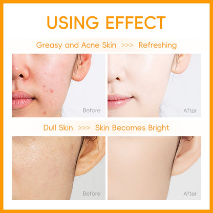 🔥Hot sale recently🔥Fenyi Vitamin C Facial Cleanser Cleansing Pores Moisturizing Cleanser✅