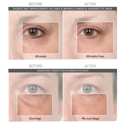 🚨𝑳𝑨𝑺𝑻 𝑫𝑨𝒀 𝑫𝑰𝑺𝑪𝑶𝑼𝑵𝑻: 𝟖𝟕% 𝑶𝑭𝑭 🔥 Instant Wrinkle Eye Tightener Cream