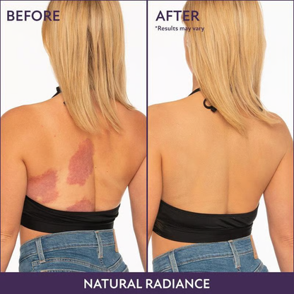 🎁Last Day Promotion ✨ - All Over Complexion Perfector