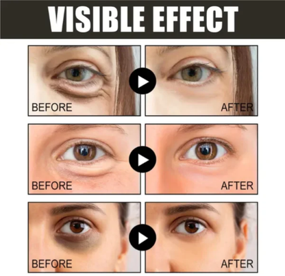 【Black Friday,50 %off,】Caffeine eye cream