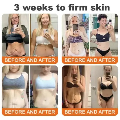 👨‍⚕️ Made and Shipped from US✅  Tlopa® Bee Venom Multi-Symptom Skin Treatment Cream