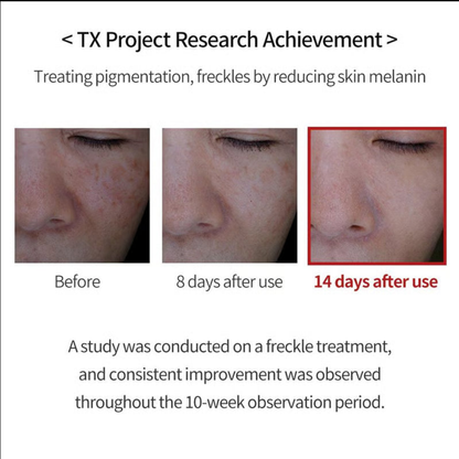 TX Cream -for Dark Spots & Hyperpigmentation