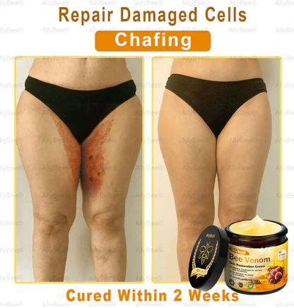 Mayo Clinic Official: AllyBee® Skin Treatment Cream Anti-aging, Hydrating, Skin Repair, Even Tone, Acne and Dark Spot Treatment, Wart and Mole Removal, Psoriasis Relief