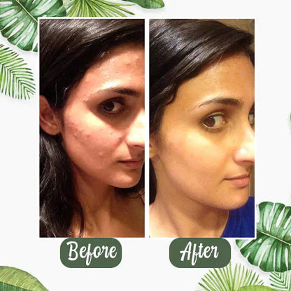 MatchaGlow™ – Clarifying Face Mask